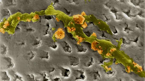 Alamy At a microscopic level, even the seemingly smooth surface of a tooth has plenty of crevices for microbes to live in (Credit: Alamy)